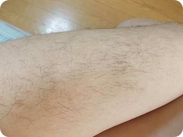 ケノンを使って女性の気になる足の毛を脱毛しました。ケノンを使用して脱毛する前の最初の状態の写真です。いわゆるビフォー写真。